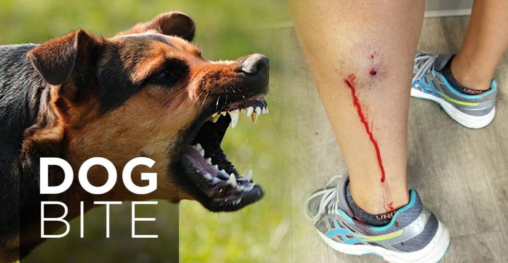 Dog Bite